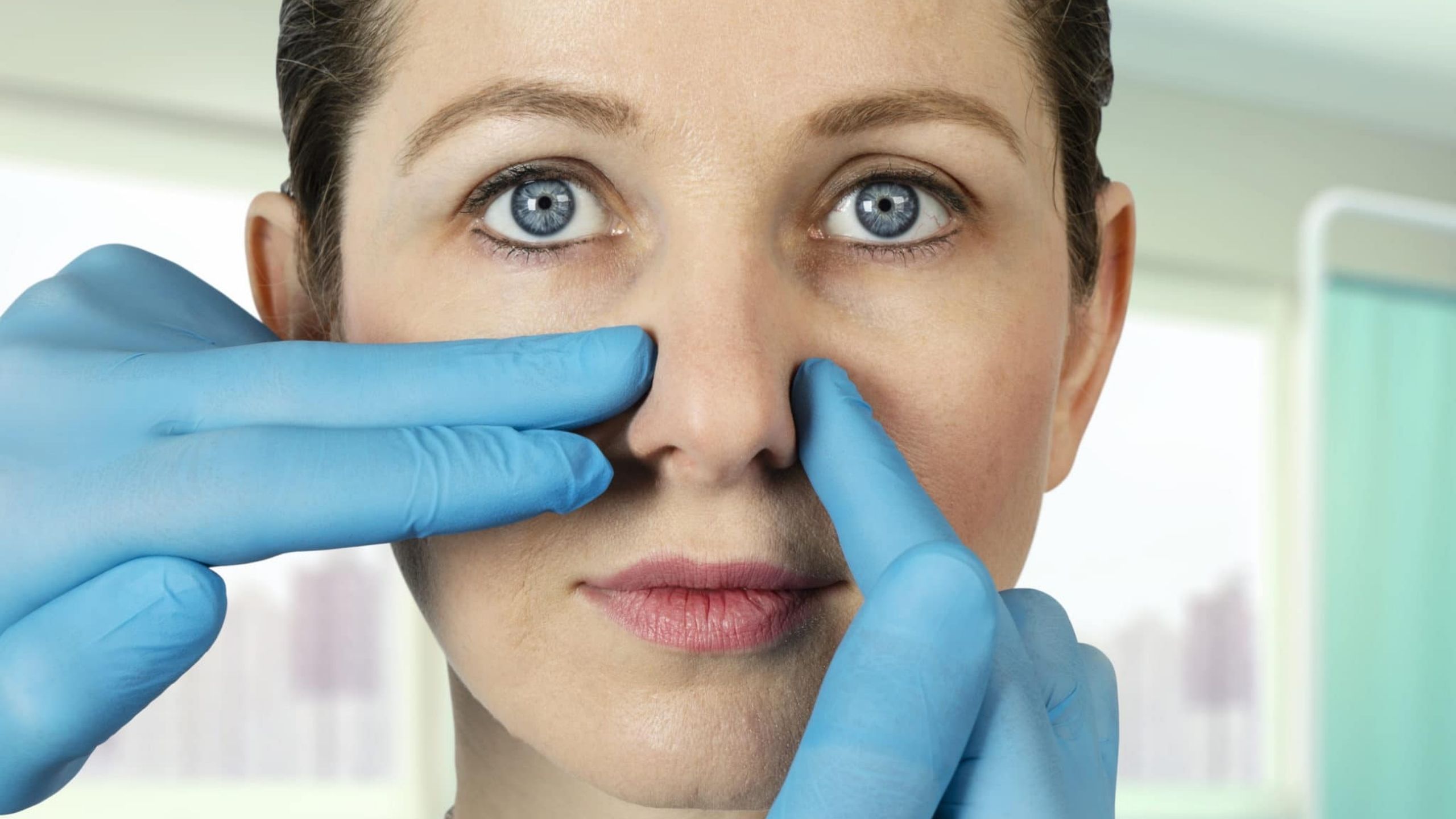 Nasal Septum Deviation
