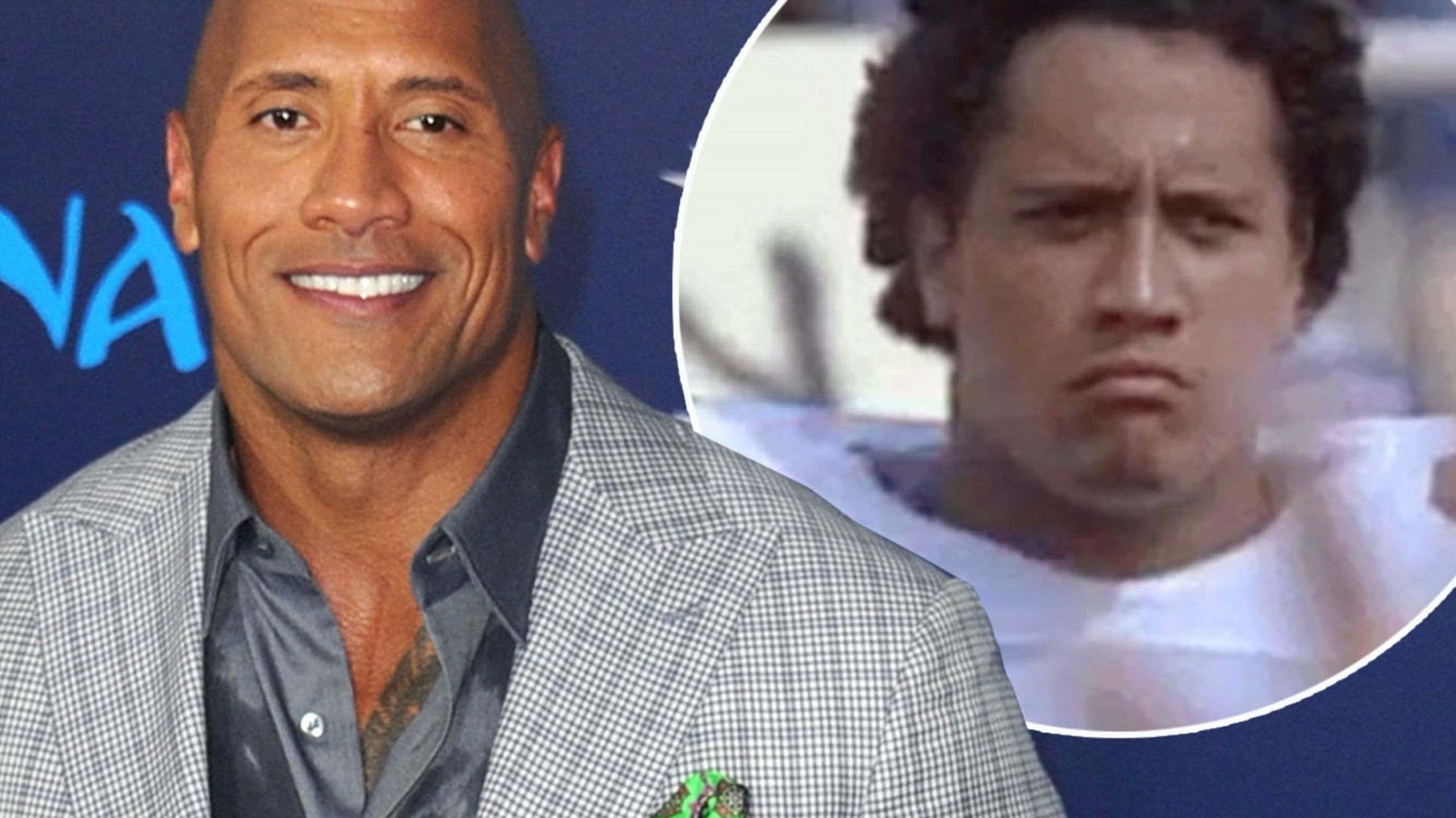 The Rock With Hair: Will Dwayne Johnson Ever Get His Hair Back?