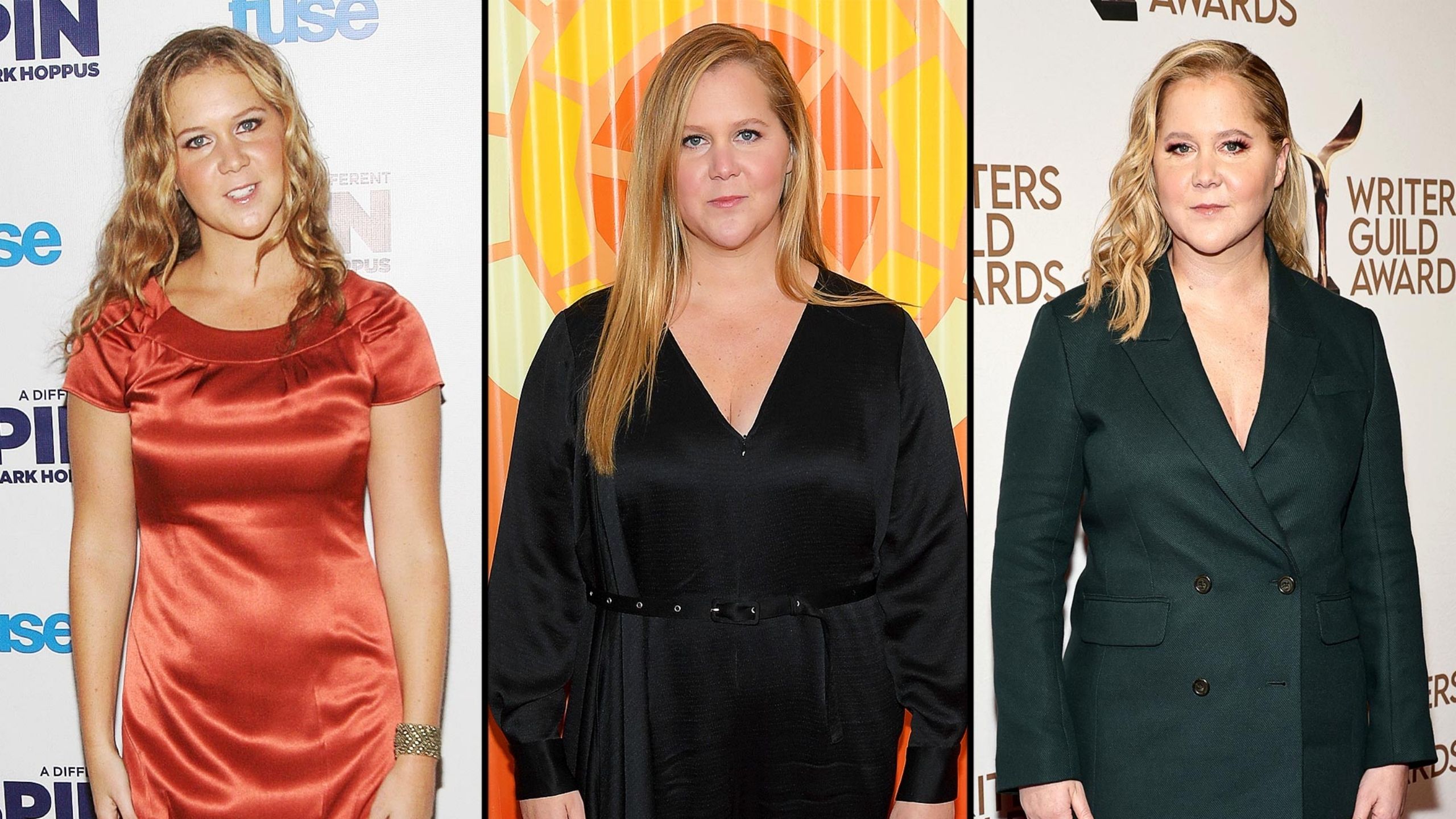 Amy Schumer Liposuction