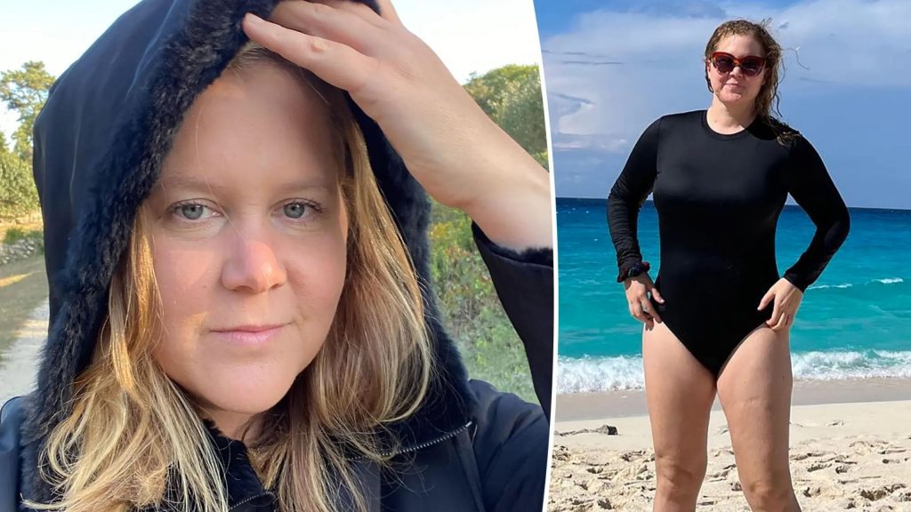 Amy Schumer Liposuction