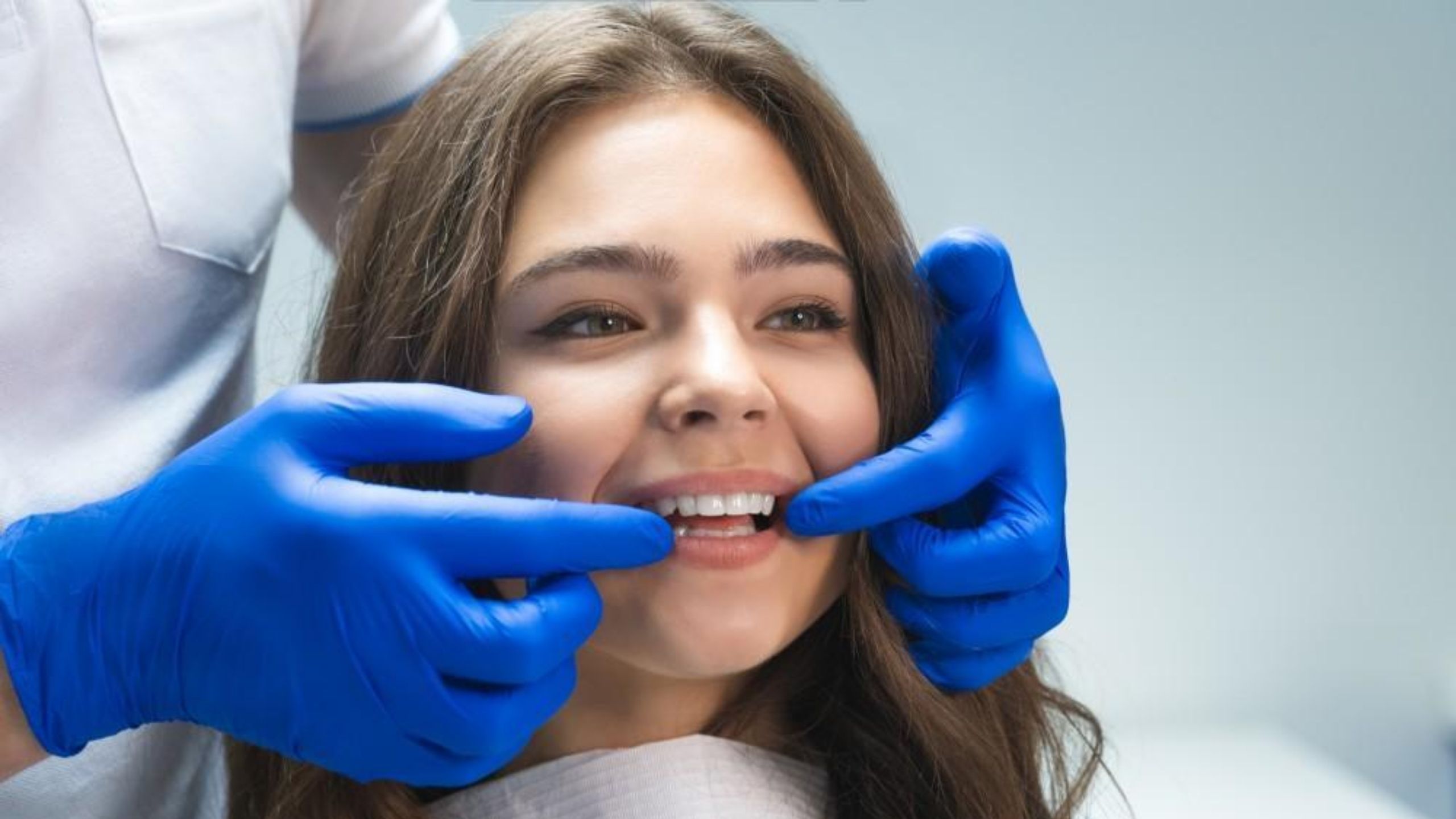 Common Questions About Dental Veneers: A Complete Guide
