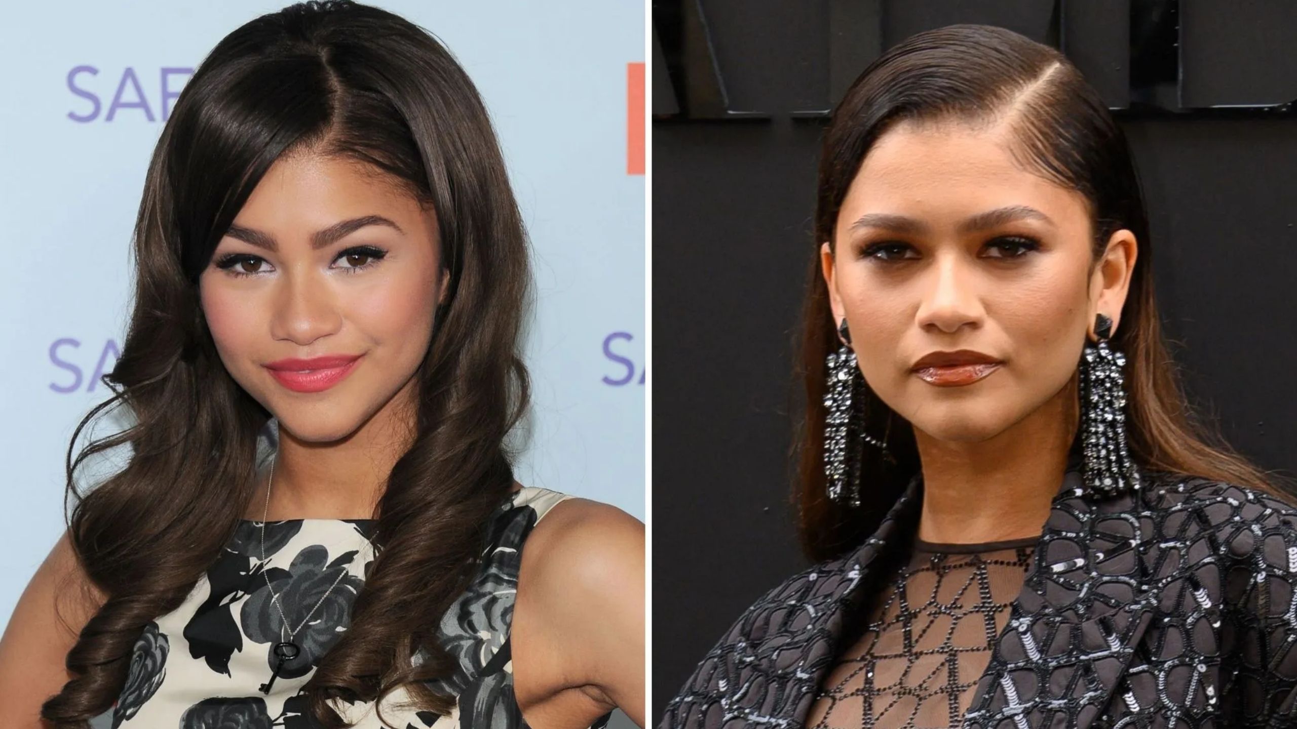 Did Zendaya Have Plastic Surgery - Surgerytr