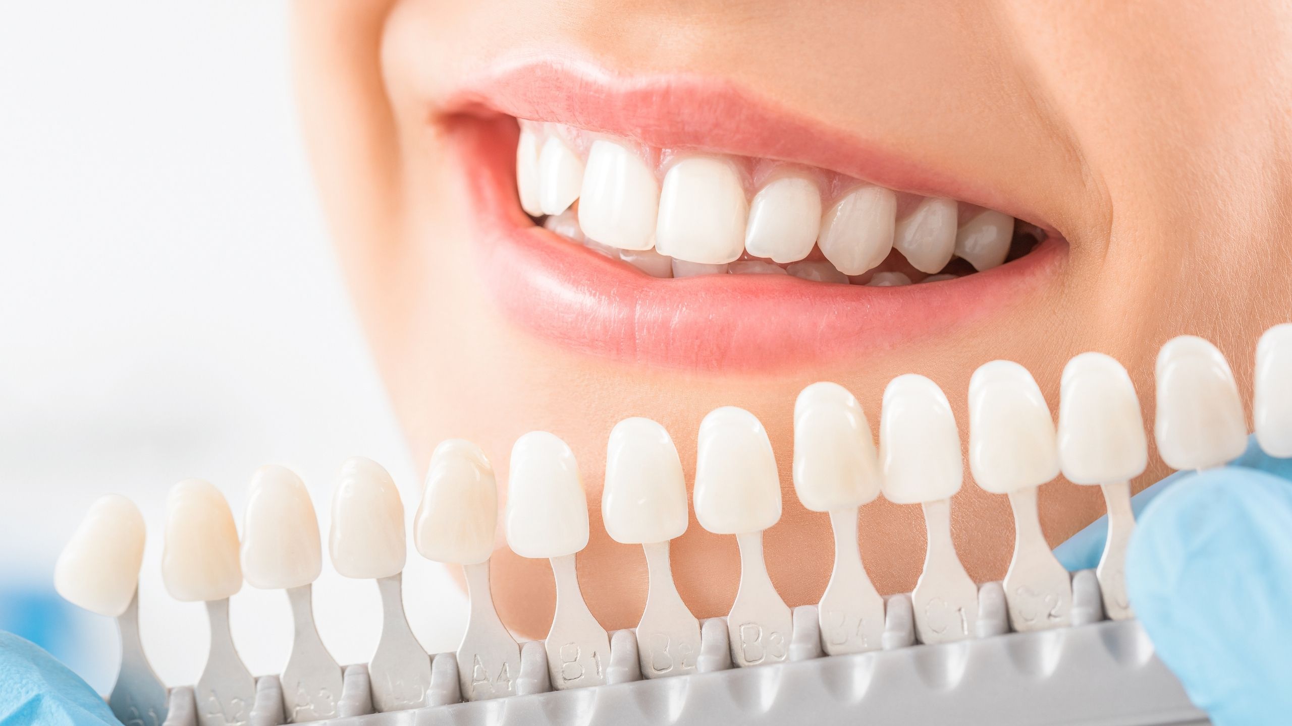 Everything You Need to Know About Dental Crowns