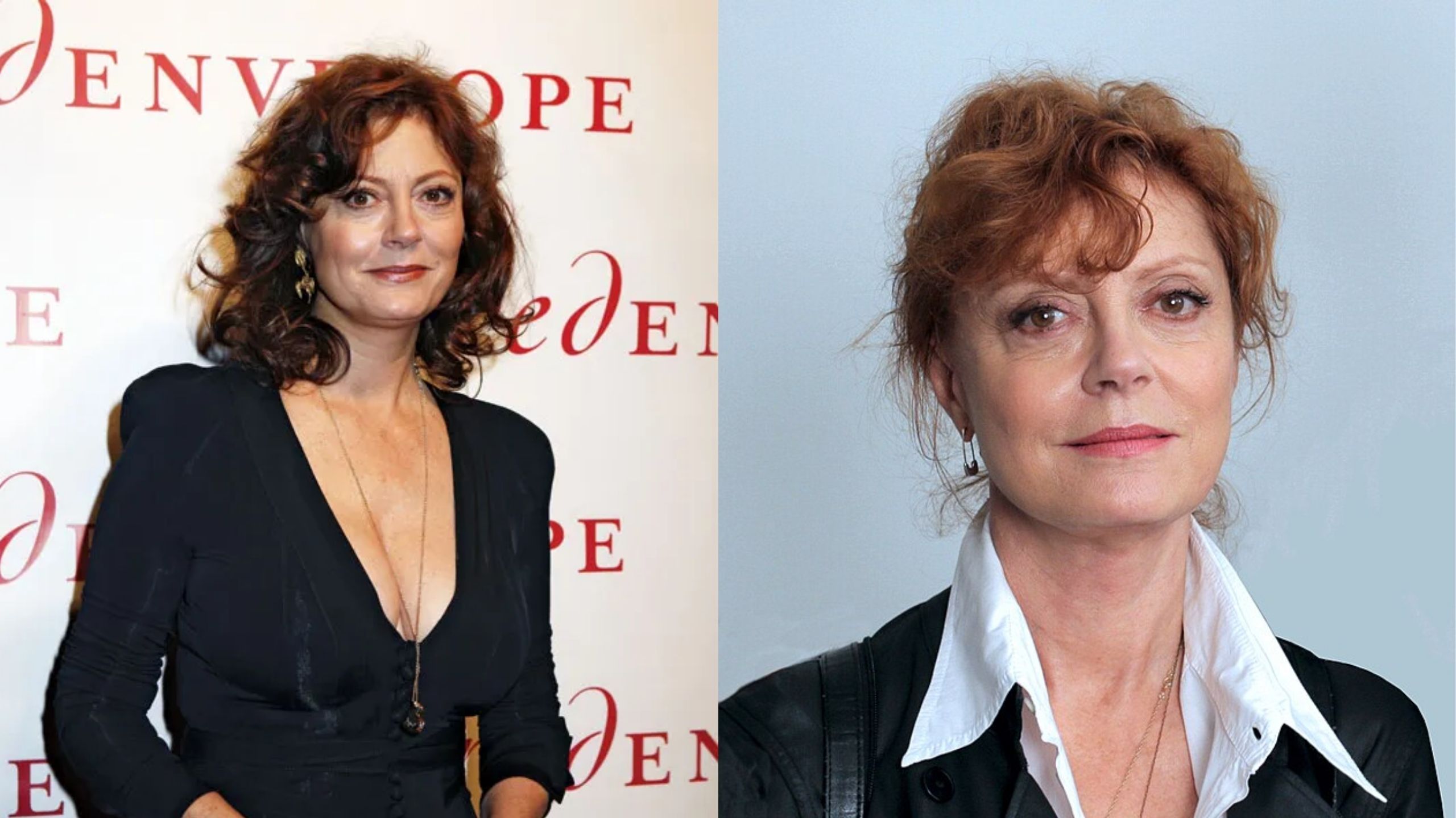 Susan Sarandon Liposuction