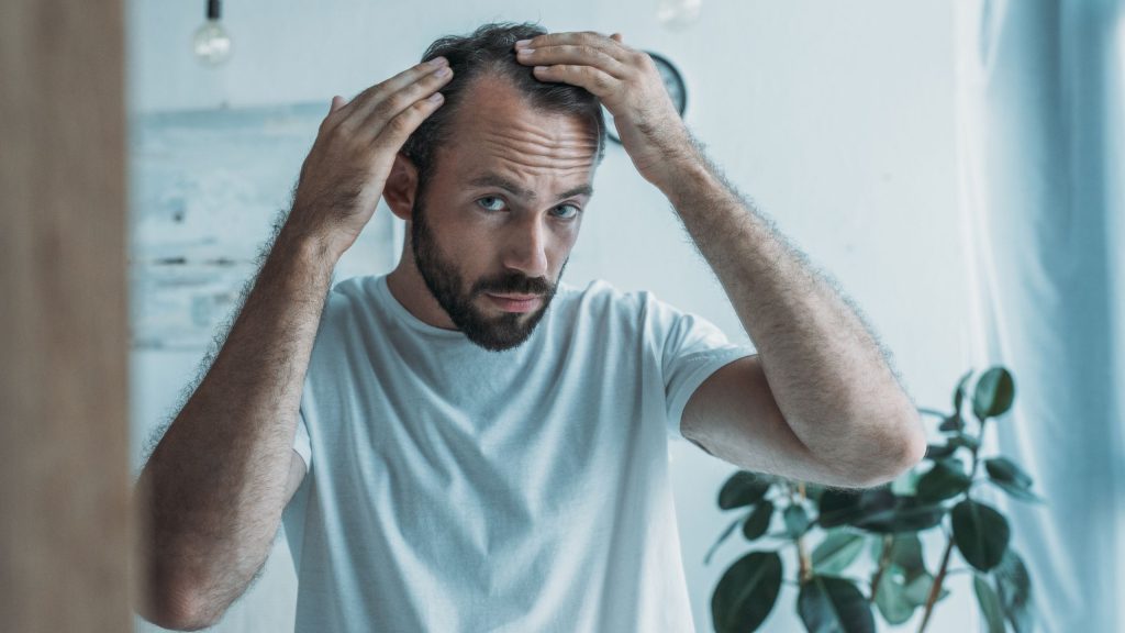 Understanding Different Types of Hair Loss 2