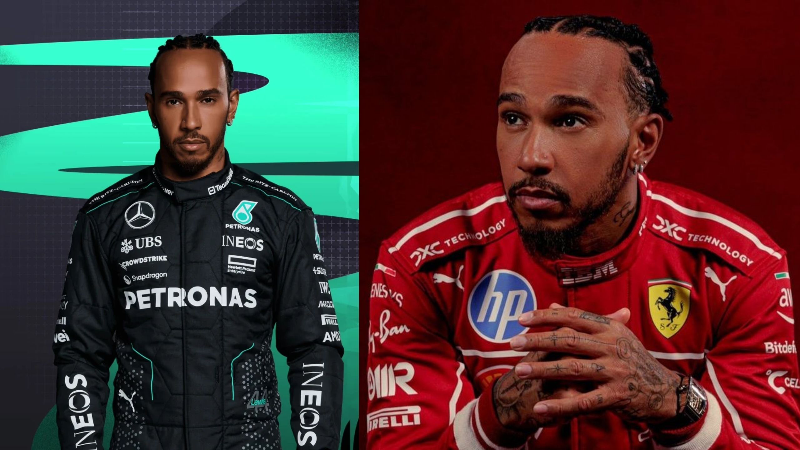 Lewis Hamilton Hair Transplant