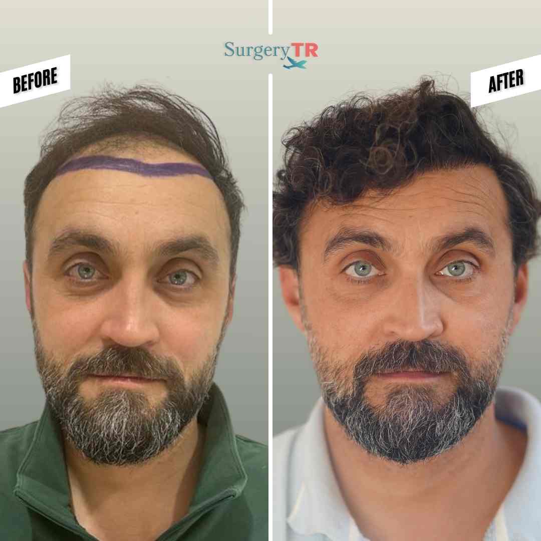 tRUST THE PROCESS Instagram Gonderisi 4