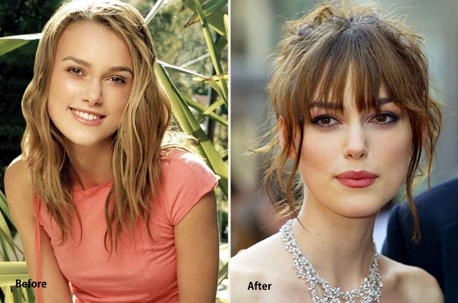 Did Keira Knightley Have Plastic Surgery? Natural Beauty or Surgical Enhancements?