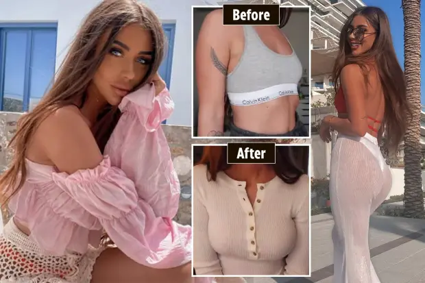 What to Consider When Choosing Cosmetic Surgery: Danielle Mansutti’s Lawsuit and Why You Should Choose a Quality Clinic