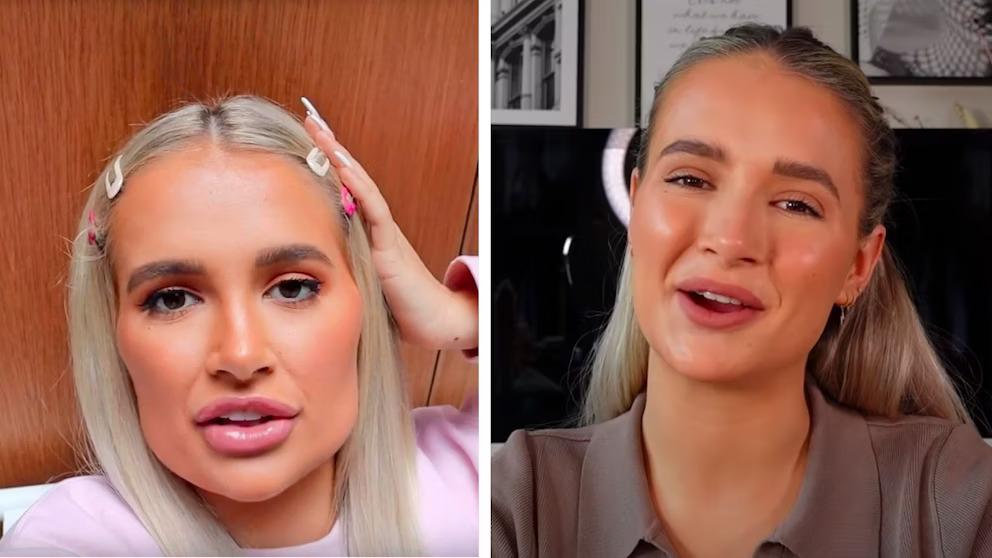 La estética de “apariencia natural” en Turquía: ¿Es posible lucir como Molly-Mae?