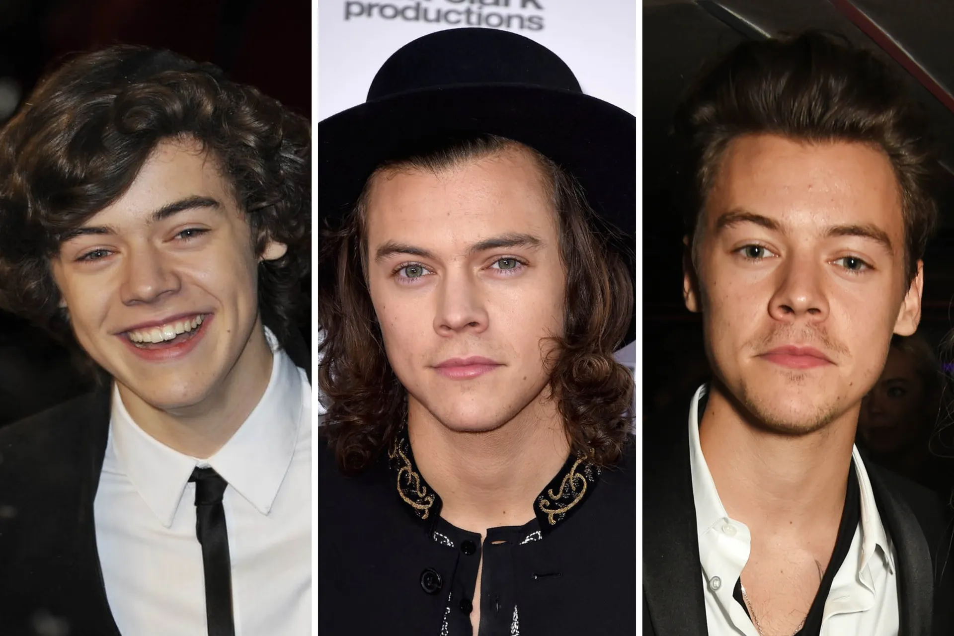 Harry Styles’ Nose Job and Youthful Look: Natural or Cosmetic Surgery?