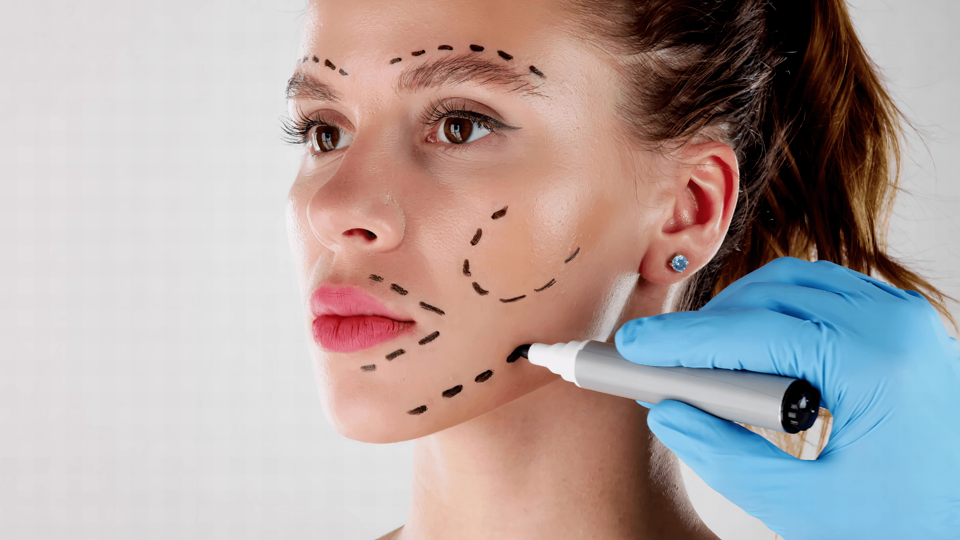 The Ultimate Facelift Guide: Which Procedure is Best for You?