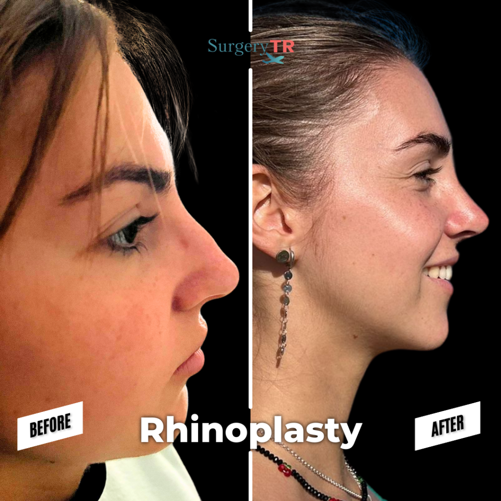 Anne Hathaway’s Youthful Met Gala Appearance: Natural Beauty or Subtle Surgery? 4 tRUST THE PROCESS Instagram Gonderisi 82
