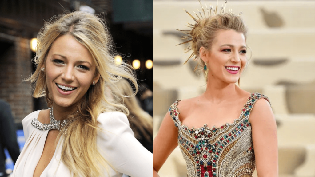 Blake Lively’s Aesthetic Elegance and the Rise of Health Tourism in Türkiye 2 Adsiz tasarim 2025 06 18T123006.844 min 1