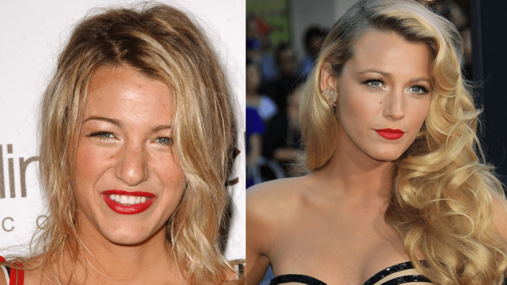 Blake Lively’s Aesthetic Elegance and the Rise of Health Tourism in Türkiye 1 Adsiz tasarim 2025 06 18T123014.304 min 1