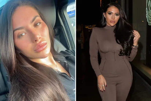 Chloe Brockett Cancels Cosmetic Surgery in Turkey: The Psychological Side of Health Tourism 1 COMPS DD CHLOE 1