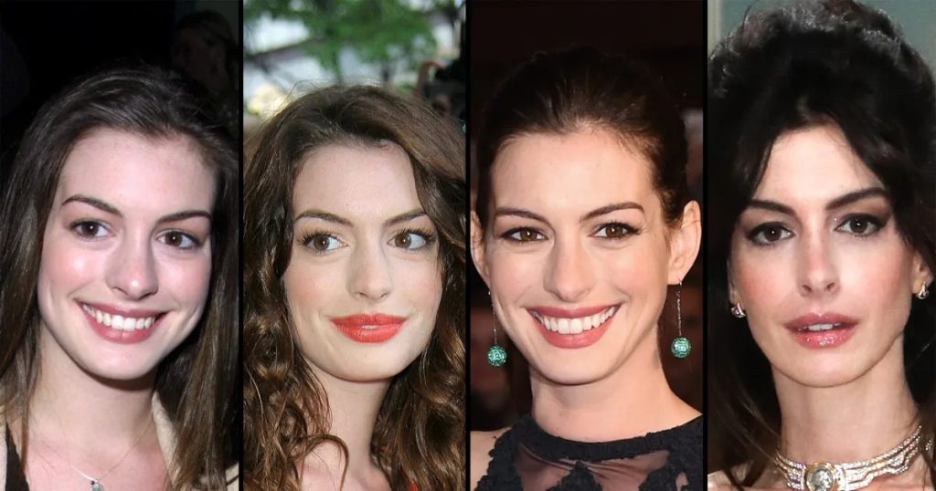 Anne Hathaway’s Youthful Met Gala Appearance: Natural Beauty or Subtle Surgery? 2 Has Anne Hathaway Had Plastic Surgery
