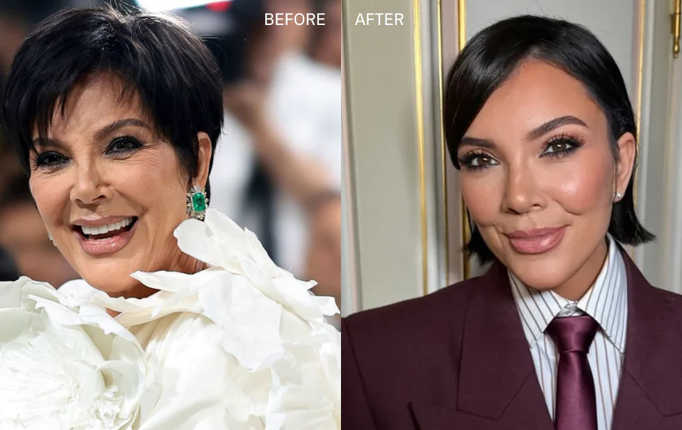 Kris Jenner’s £100,000 Facelift: What’s the Secret Behind Ageless Beauty? 1 Kris Jenner New Face The All Natural Version BBB London 1