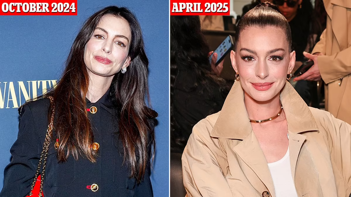 Anne Hathaway’s Youthful Met Gala Appearance: Natural Beauty or Subtle Surgery?