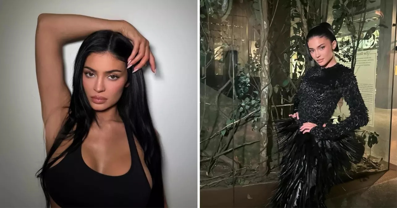 Kylie Jenner’s Disclosure of 445 cc Implants: Is Transparency the New Trend in Aesthetic Surgery?