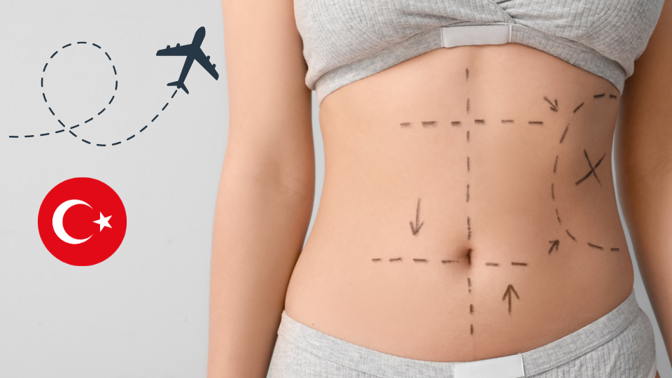 Liposuction Tourism from the UK to Turkey: What You Need to Know