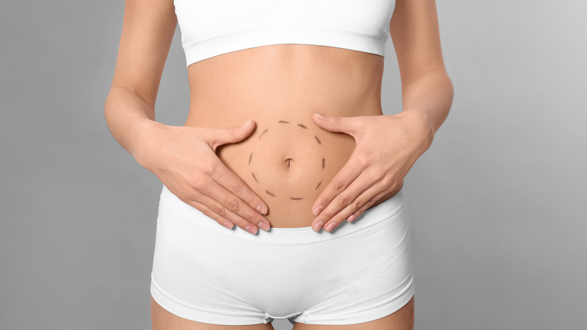 Post-Tummy Tuck Travel Experiences: Turkey’s Medical Tourism Assurance and UK Patient Insights