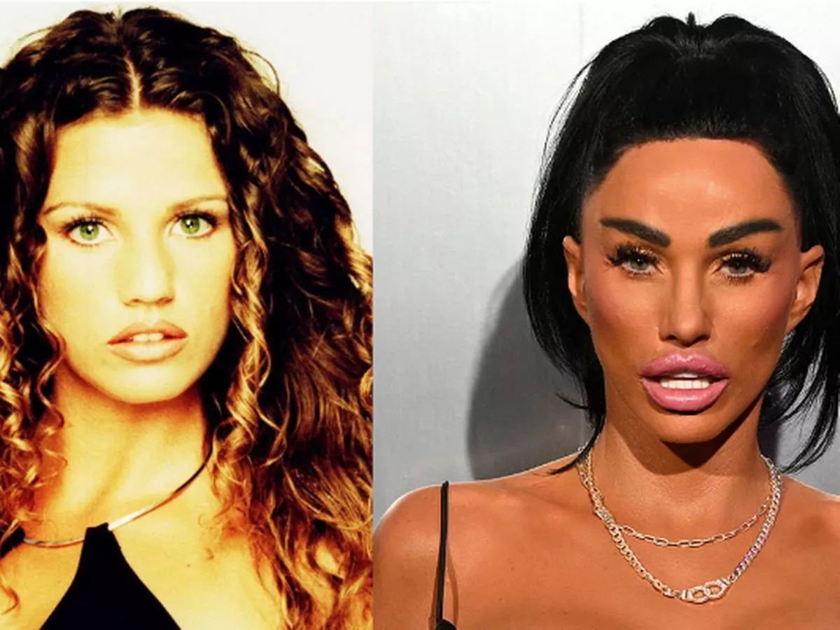 The Katie Price Case 17 Breast Surgeries Rhinoplasty And Facelifts 