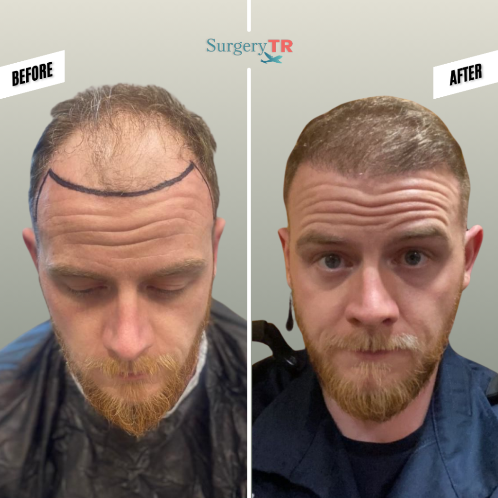 tRUST THE PROCESS Instagram Gonderisi 2025 09 17T151400.460