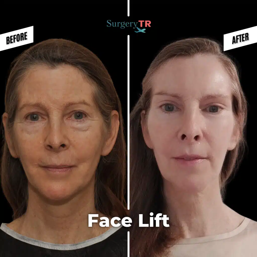 tRUST THE PROCESS Instagram Gonderisi 2026 01 14T135814.859