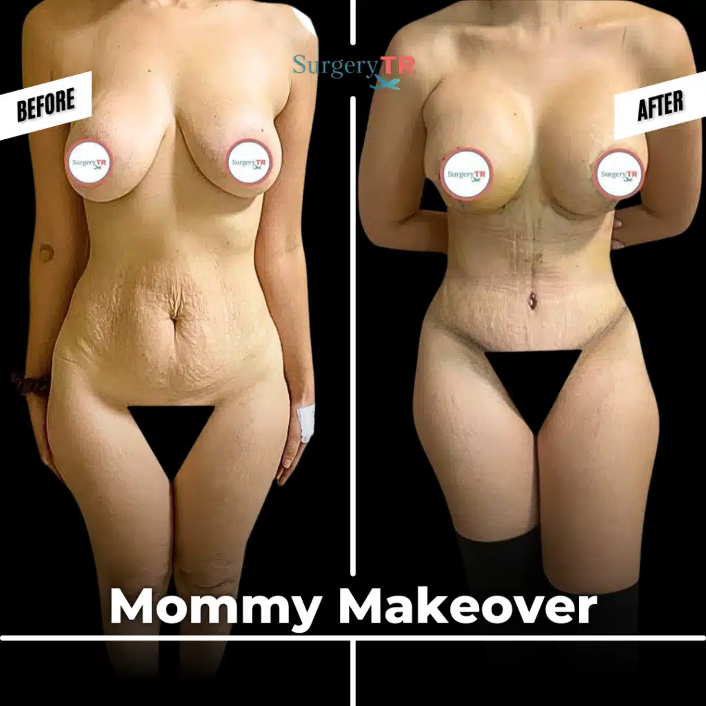 tRUST THE PROCESS Instagram Gonderisi 2026 01 14T154906.914