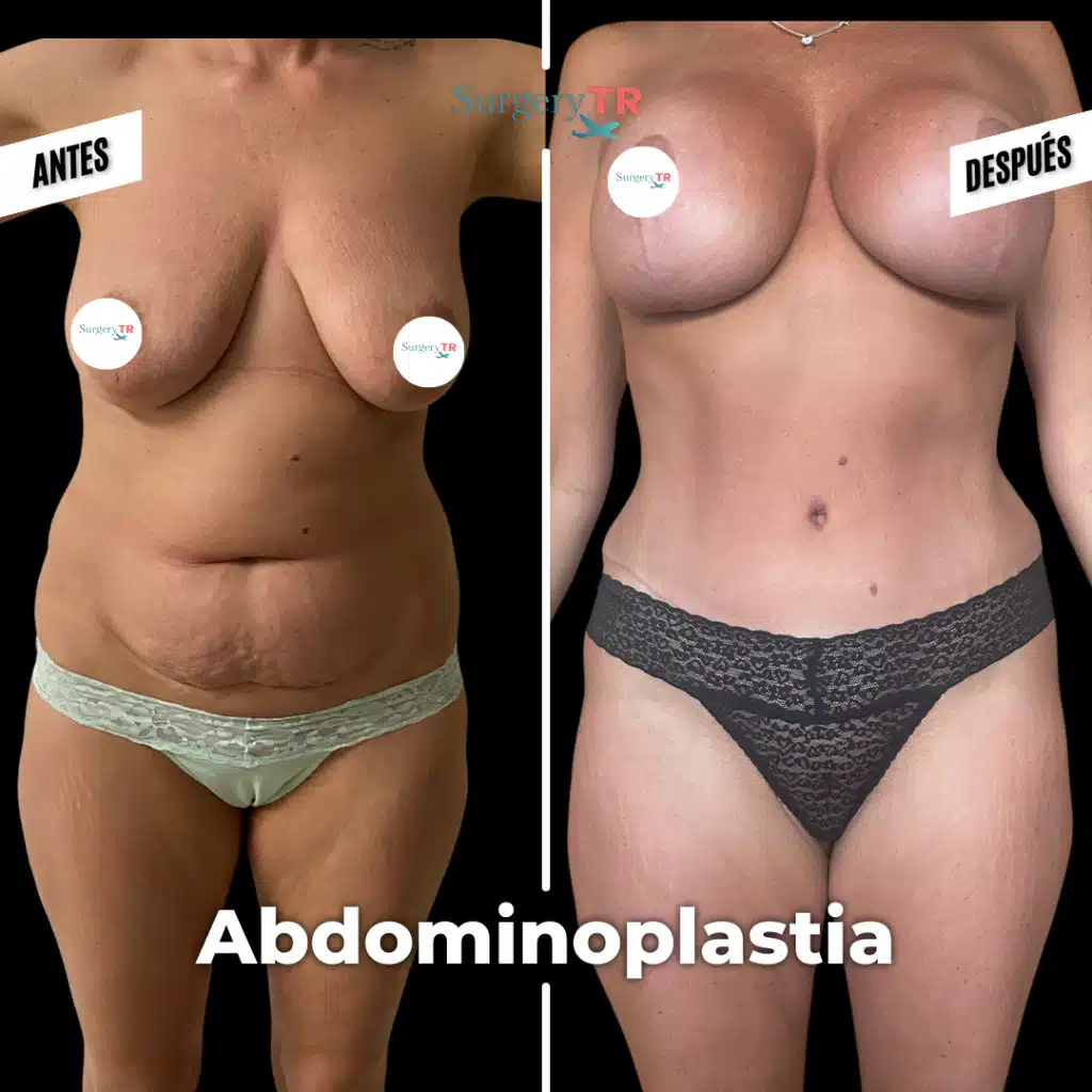 tRUST THE PROCESS Instagram Gonderisi 2026 02 25T163034.294