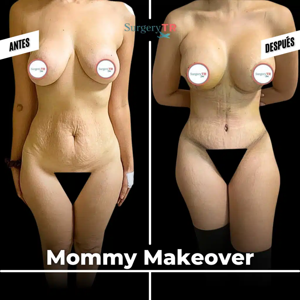 tRUST THE PROCESS Instagram Gonderisi 2026 02 25T165716.042