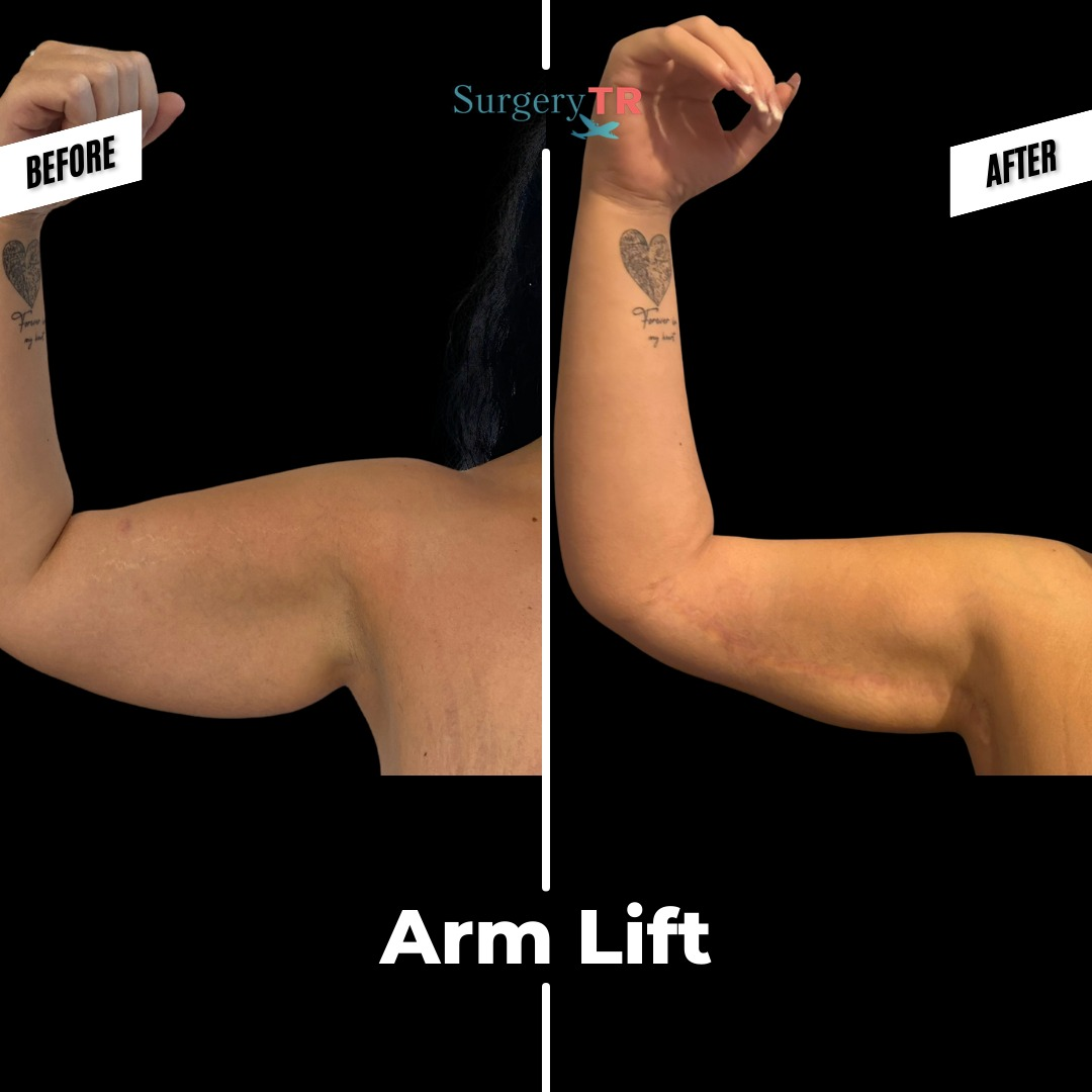 WhatsApp Gorsel 2025 03 04 saat 10.34.18 308e0bc1