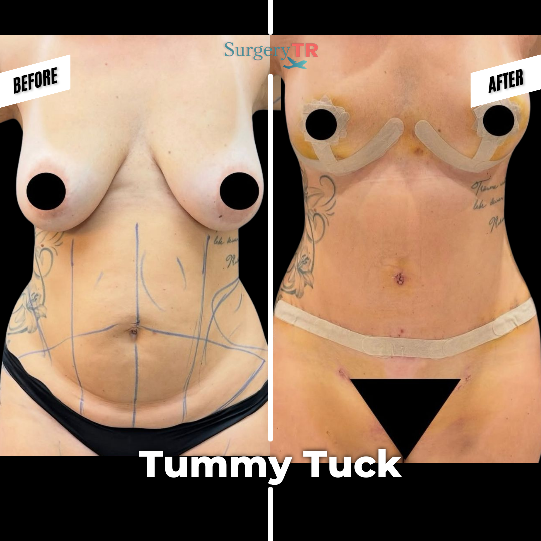 tRUST THE PROCESS Instagram Gonderisi 2026 03 02T123254.654