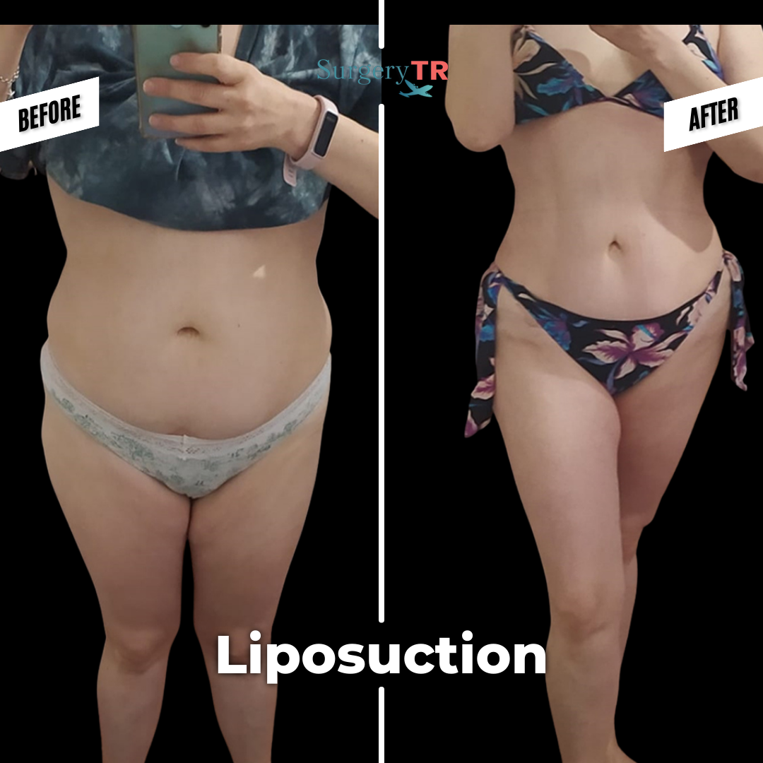 tRUST THE PROCESS Instagram Gonderisi 2026 03 02T143946.242