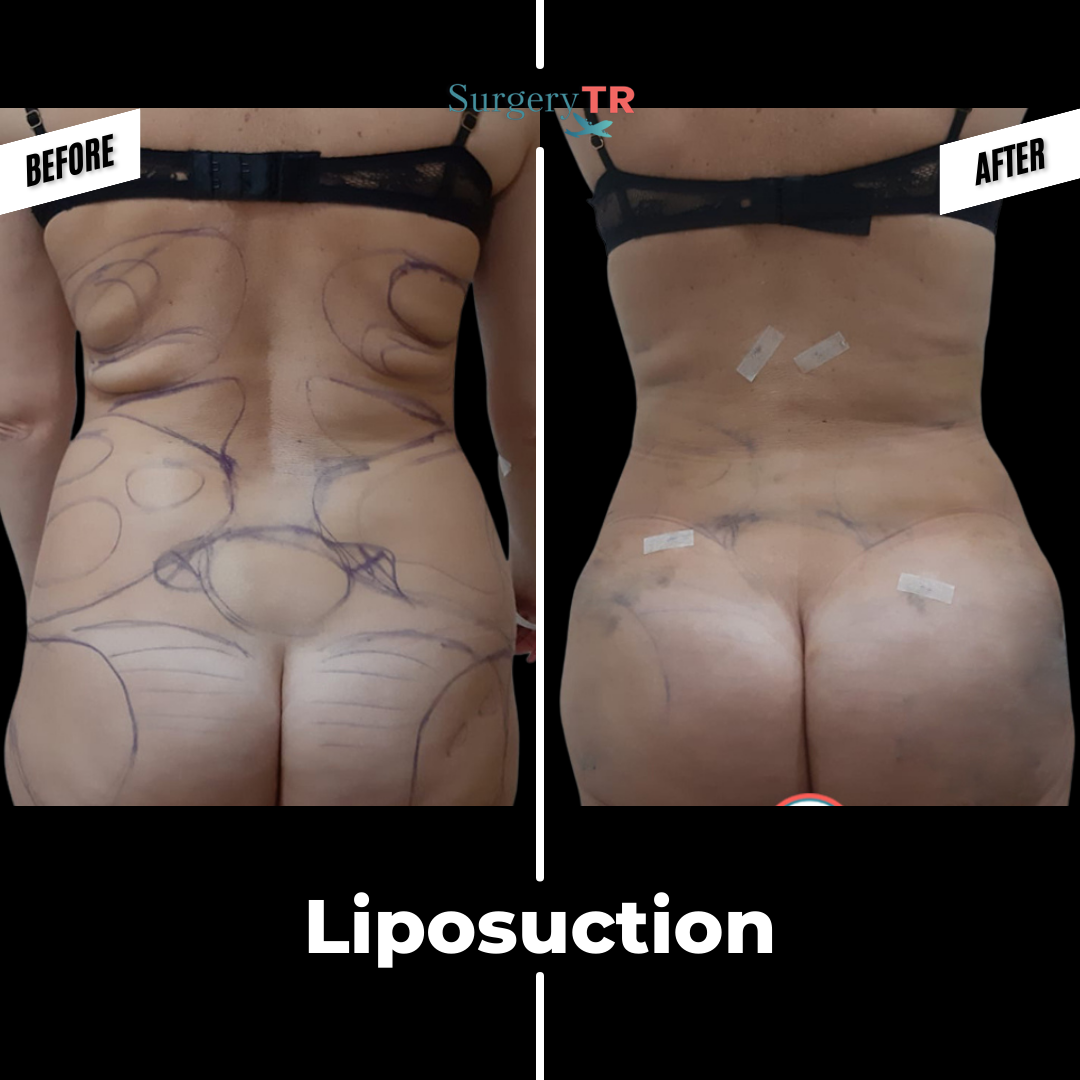 tRUST THE PROCESS Instagram Gonderisi 2026 03 02T144025.328