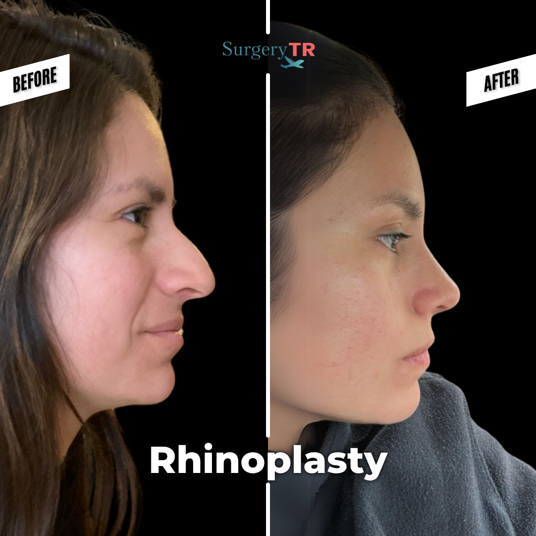 tRUST THE PROCESS Instagram Gonderisi 92 3