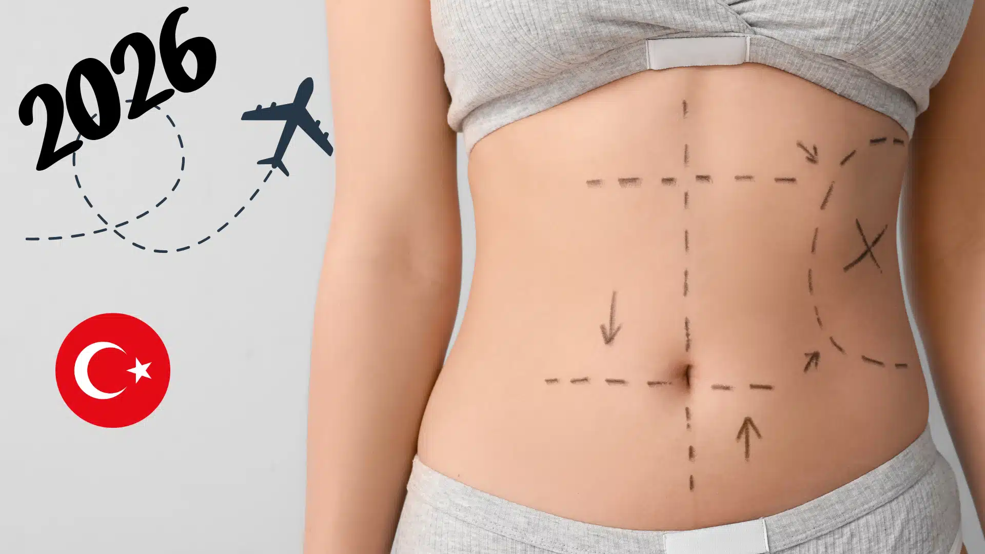 Health Tourism Trends in 2026: What Patients Expect Now