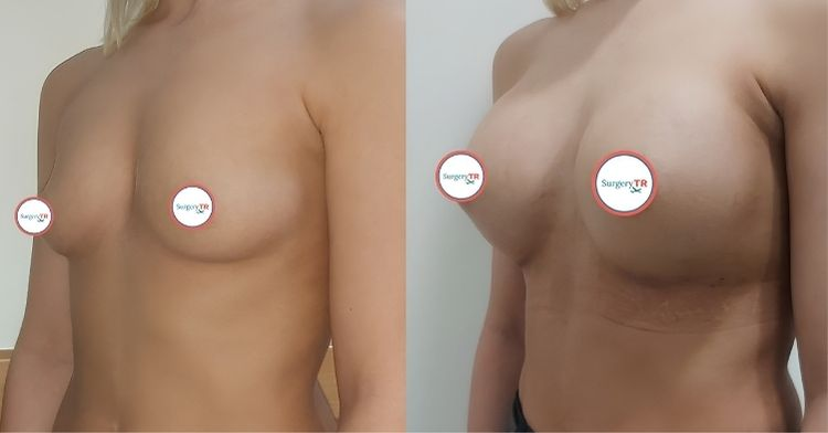 Share your related pictures for initial assessment get your customized treatment plan and fly 1200 x 628 piksel